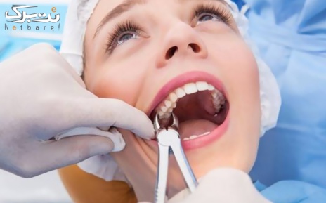 جرم گیری دندان در کلینیک دندانپزشکی معلم