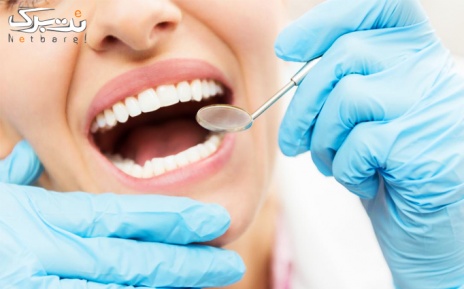 بلیچینگ دندان توسط دکتر افشاری