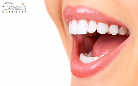 ترمیم دندان با آمالگام توسط دکتر اله وردی