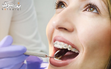 ترمیم دندان در کلینیک زیبایی قرن 21