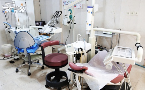 انجام روکش دندان (pfm) در مطب دکتر عبدی
