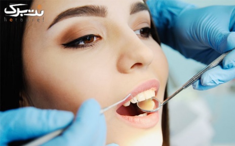 ترمیم و رفع پوسیدگی در مرکز دندانپزشکی ایساتیس
