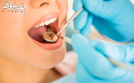 جرمگیری در دندانپزشکی دکتر آرام