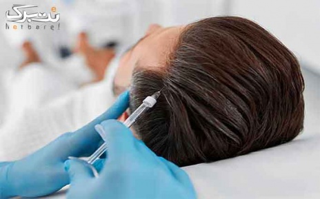 مزوتراپی موی سر برند کره ایی در مرکز درمانی میکال
