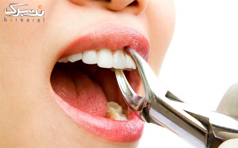 عصب کشی چهار کانال در دندانپزشکی دکتر دایر