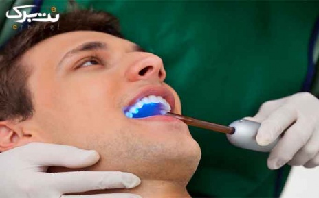 فیشور سیلندر (واحدی) در مرکز دندانپزشکی کریستال