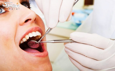 پکیج 2: سفید کردن دندان