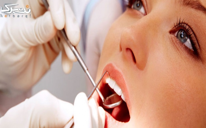 جرم گیری و بروساژ دندان تنها 18400 تومان