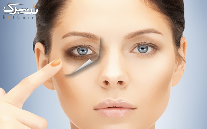 پاکسازی تخصصی صورت در مطب دکتر نصیری