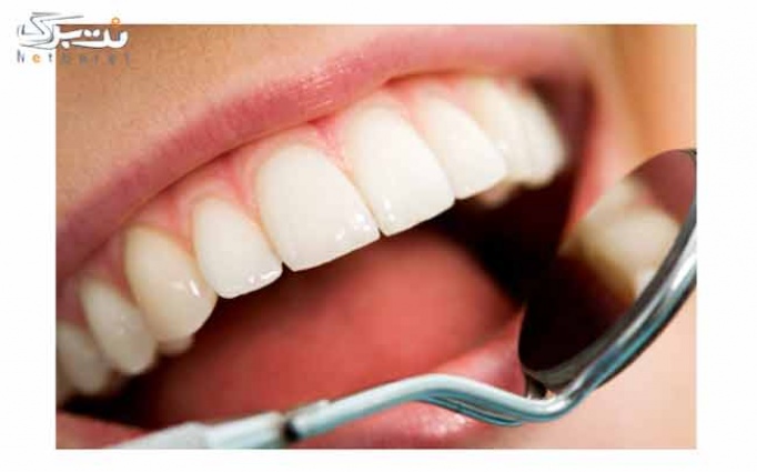 جرمگیری با بروساژ  دندان در کلینیک گلبرگ 