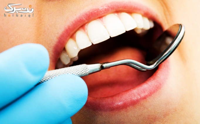جرمگیری دندان و بروساژ دندان در مطب دکتر عزیزی
