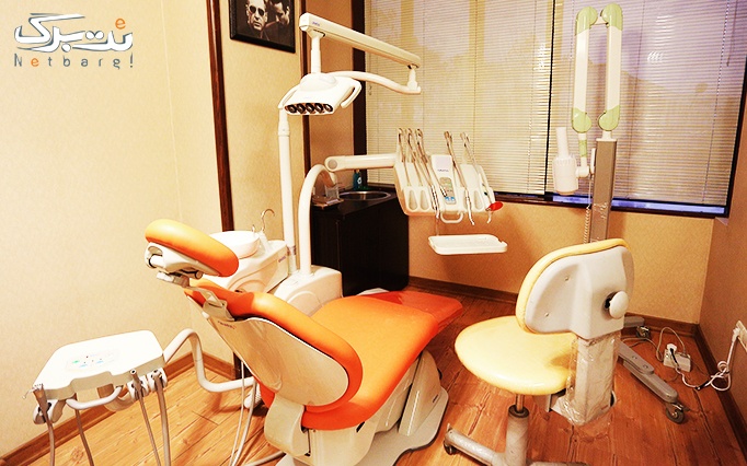 کامپوزیت دندان در مطب دکتر قاضی