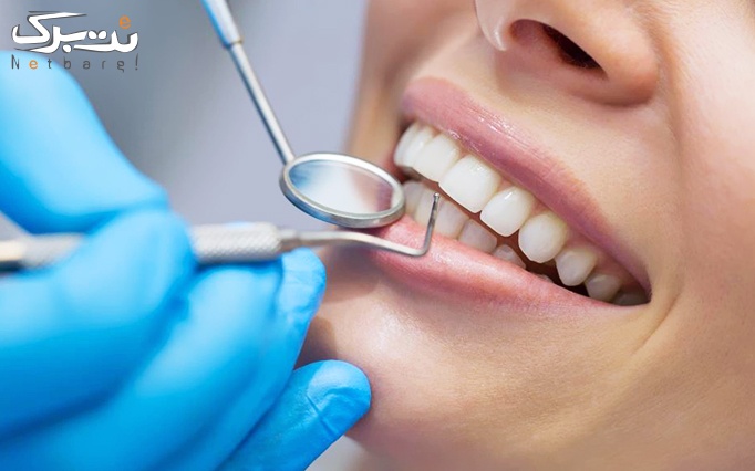 جرمگیری دندان در مطب دکتر فروتن نژاد