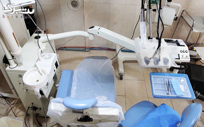 پر کردن دندان با کامپوزیت هر واحد در مطب دکتر عبدی