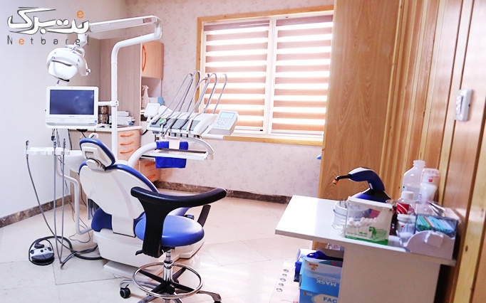 کامپوزیت ونیر دندان در مطب دکتر خلف