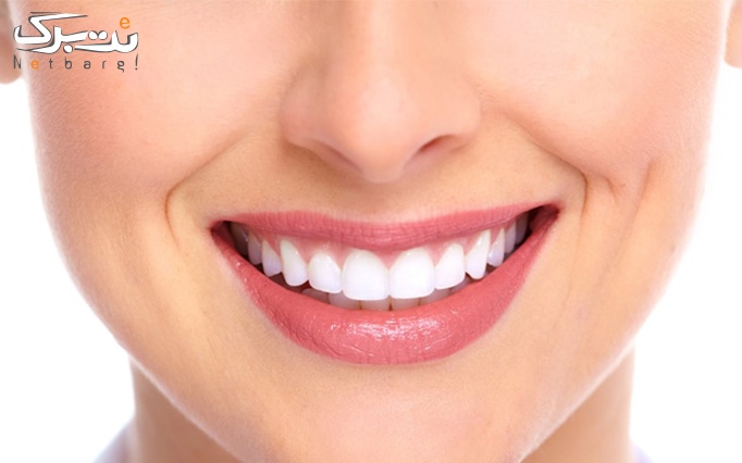 خدمات دندانپزشکی در مجموعه ونیر زیبایی