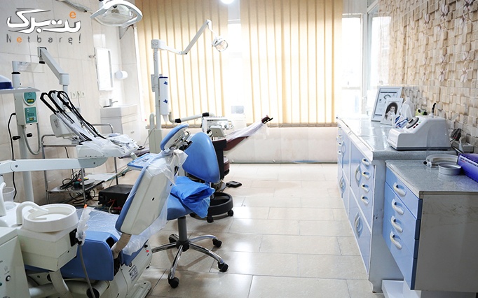 کامپوزیت ونیر هر واحد دندان در مطب دکتر فاطمه عبدی