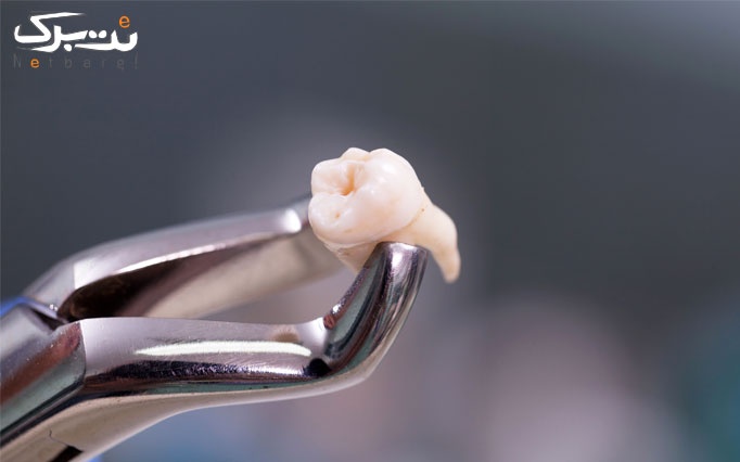 انواع خدمات دندانپزشکی در مطب دکتر رجبیان
