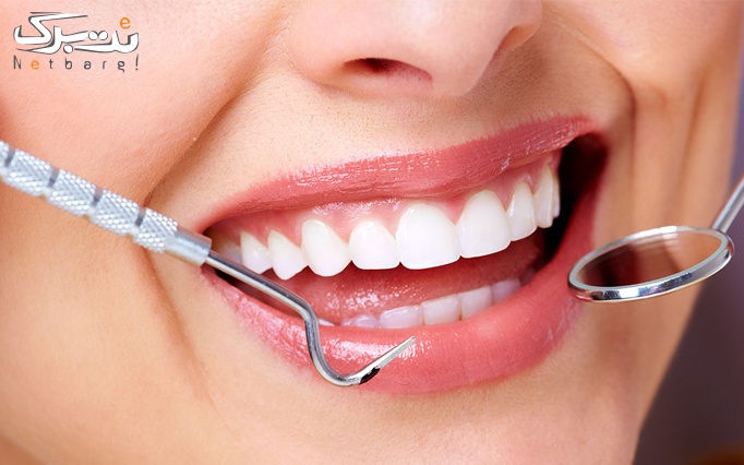 خدمات دندانپزشکی در کلینیک زیبایی قرن 21
