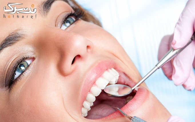 کشیدن دندان شیری در مرکز دندانپزشکی اشرفی