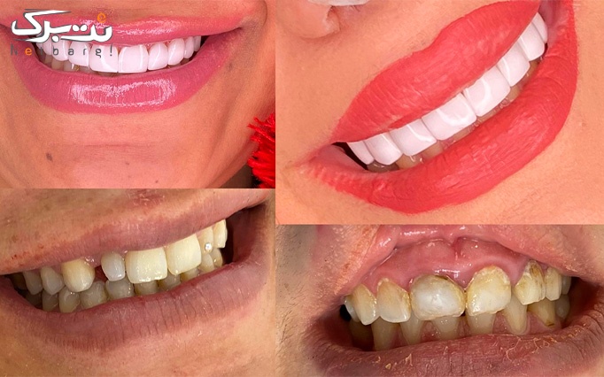 خدمات دندانپزشکی در دندانپزشکی اسمایل سنتر