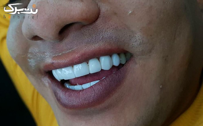 خدمات دندانپزشکی در مطب دکتر راحله مدانلو