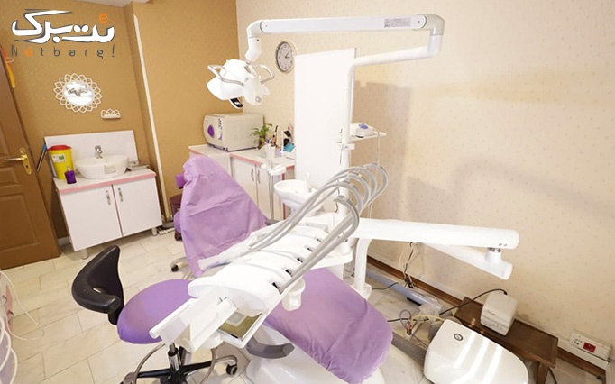 کامپوزیت دندان توسط دکتر پازوکی