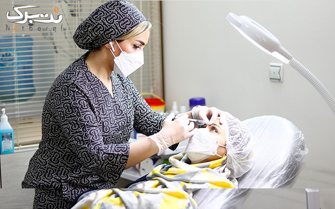 دستمزد بوتاکس دیستون در مطب زیبایی دکتر سیدزاده