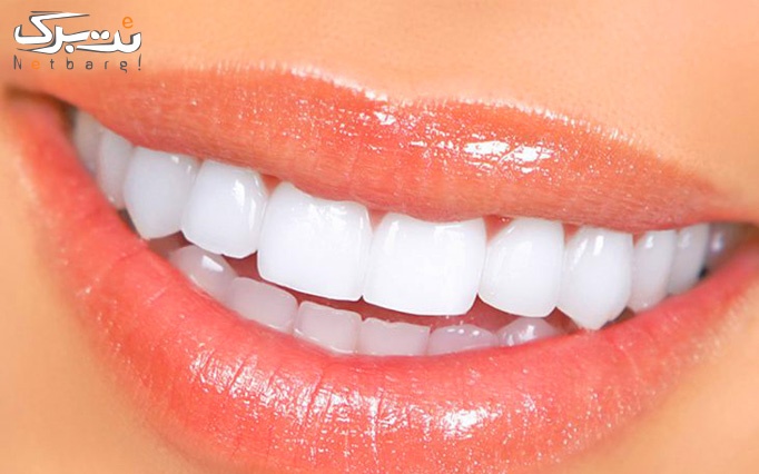 خدمات زیبایی دندان در مطب دندانپزشکی دکتر شکرگزار