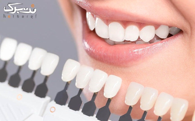 انواع خدمات دندانپزشکی در مرکز دندانپزشکی آران