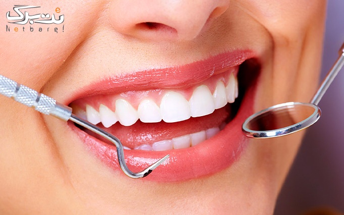کشیدن دندان عقل معمولی در مرکز دندانپزشکی آران