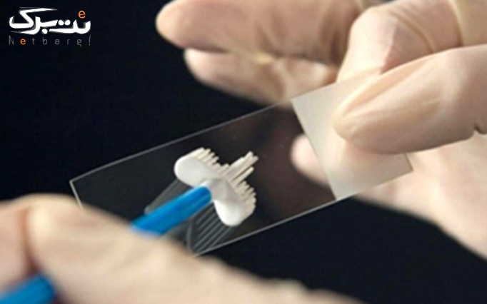 گذاشتن IUD در مطب دکتر محمدنژاد