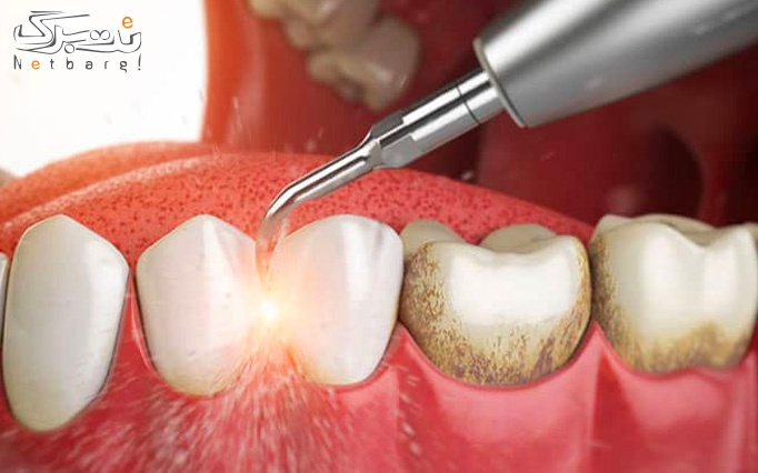 انواع خدمات تخصصی دندانپزشکی در مرکز دندانپزشکی دی