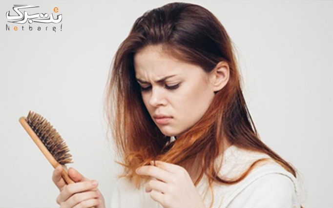 درمان ریزش مو در کلینیک شیرین بیوتی