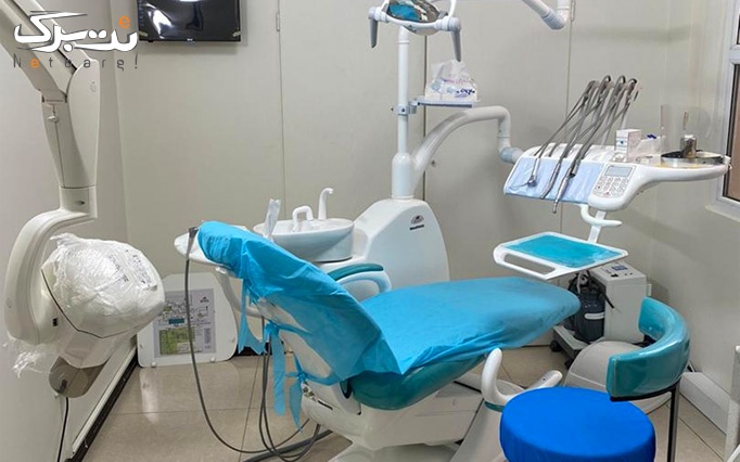 ایمپلنت دندان در مطب دندانپزشکی محمدرضا کرمی