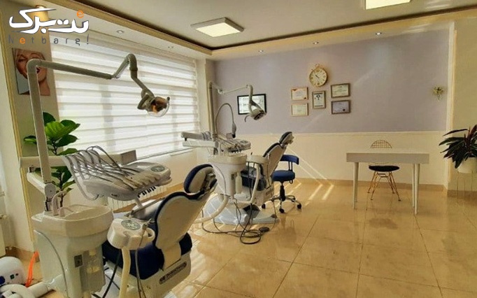 پالیش کامپوزیت هر فک در مرکز دندانپزشکی لاوین