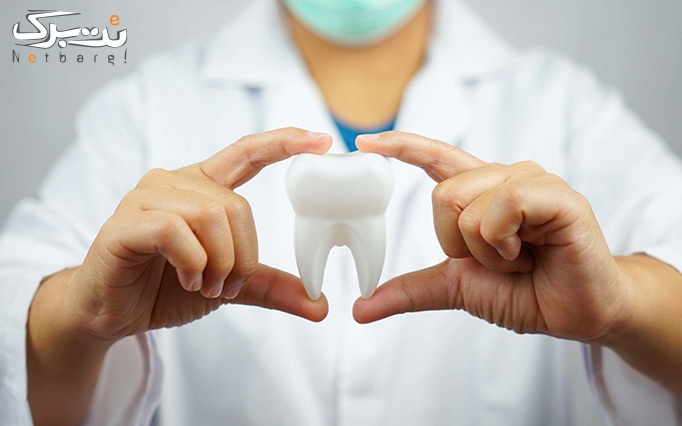 کامپوزیت ونیر در دندانپزشکی دنتال نفس