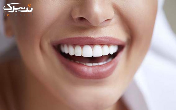 انواع خدمات دندانپزشکی در مطب دندانپزشکی مرسی