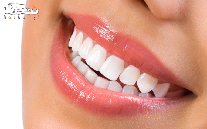 انواع خدمات دندانپزشکی در مطب دندانپزشکی مرسی