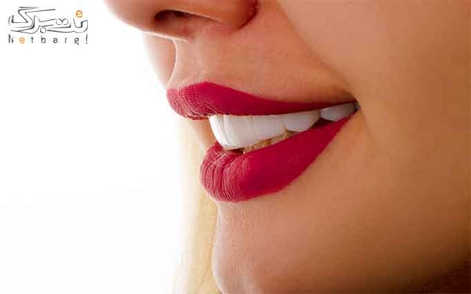 خدمات تخصصي دندان پزشكي كلينيك لبخند درمان