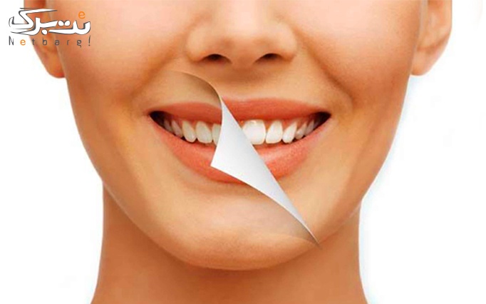 خدمات دندان در دندانپزشکی کارن