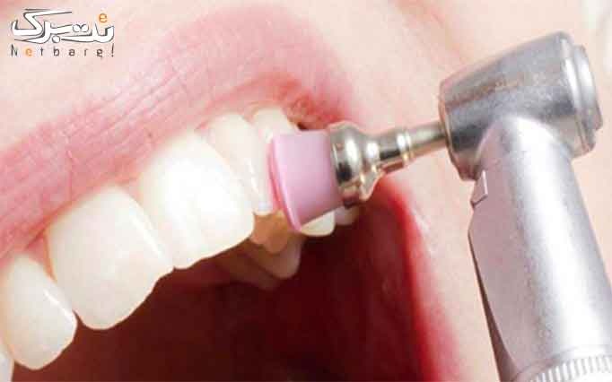 خدمات دندانپزشکی در مطب دندانپزشکی مارال قهرمانی