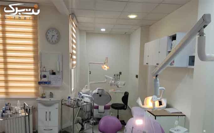 جرمگیری در دندانپزشکی دکتر ناصر مسیحی