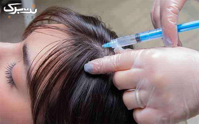 مزوتراپی موی سر در مطب پزشکی زیبایی ریجوونال