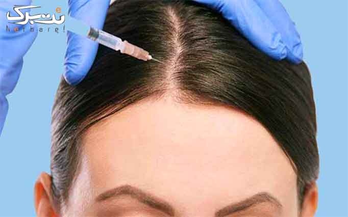 مزونیدلینگ صورت در مرکز پوست و مو گیلدا