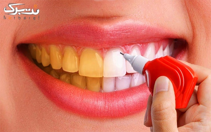 خدمات دندان در مجموعه میردنتال