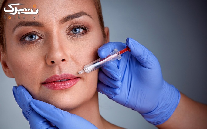 تزریق ژل و زاویه سازی صورت در مطب دکتر صادقی