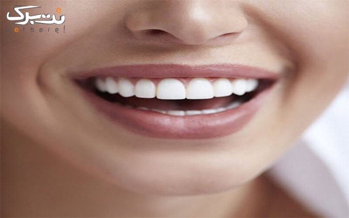 خدمات دندانپزشکی در کلینیک تخصصی و فوق تخصصی لبخند