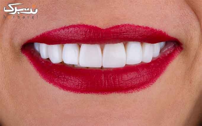 ترمیم و عصب کشی در دندان پزشكي كلينيك لبخند درمان