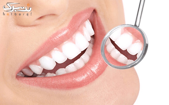 خدمات دندان در کلینیک دندانپزشکی شبانه روزی زهره